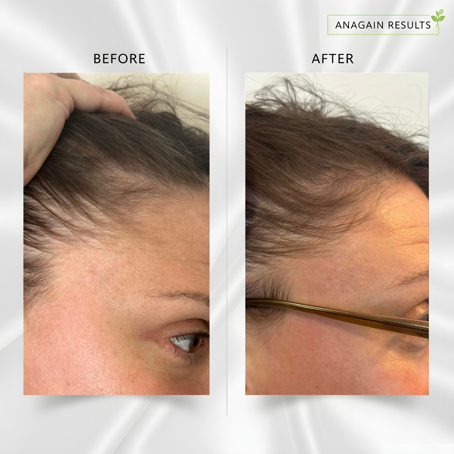 OLIEO Hair Serum x Anagain